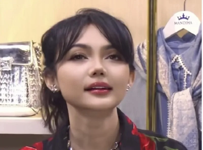 Dulu Pesek, Kini Mancung: Rina Nose Operasi Hidung? Netizen Khawatir Hoki Meredup